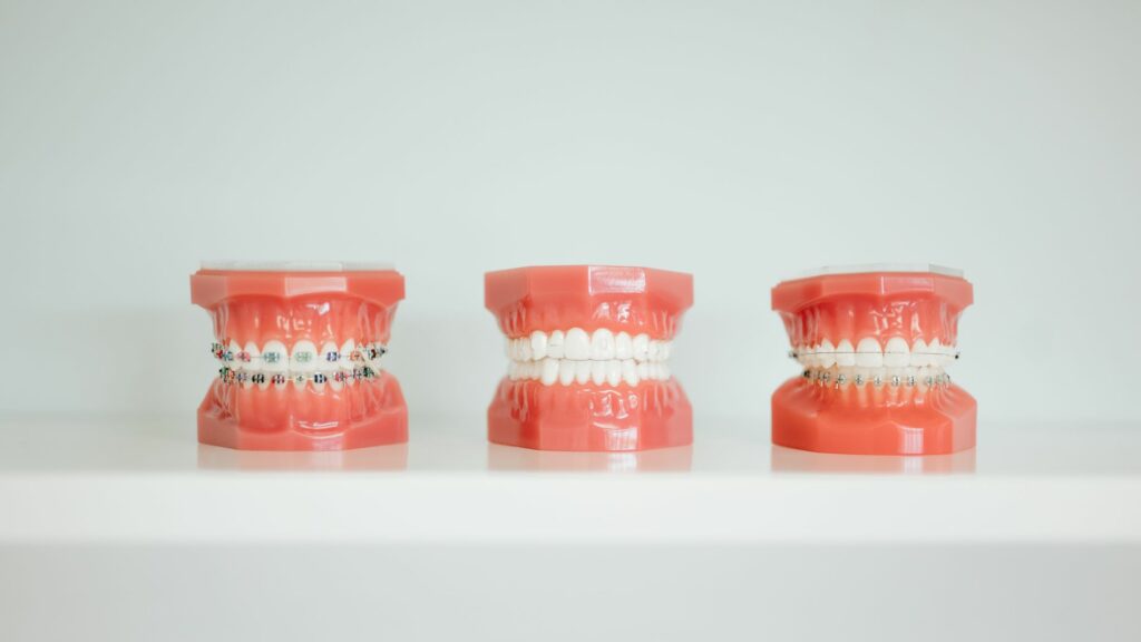 The Right Fit: Top Orthodontic Treatment Options