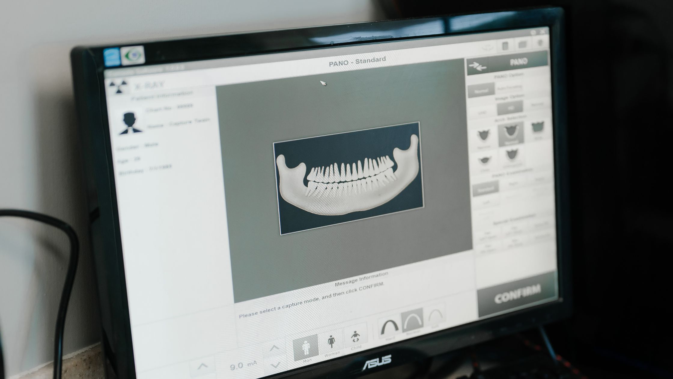 More Than Just a Pretty Smile: What Are Some of the Benefits of Braces?